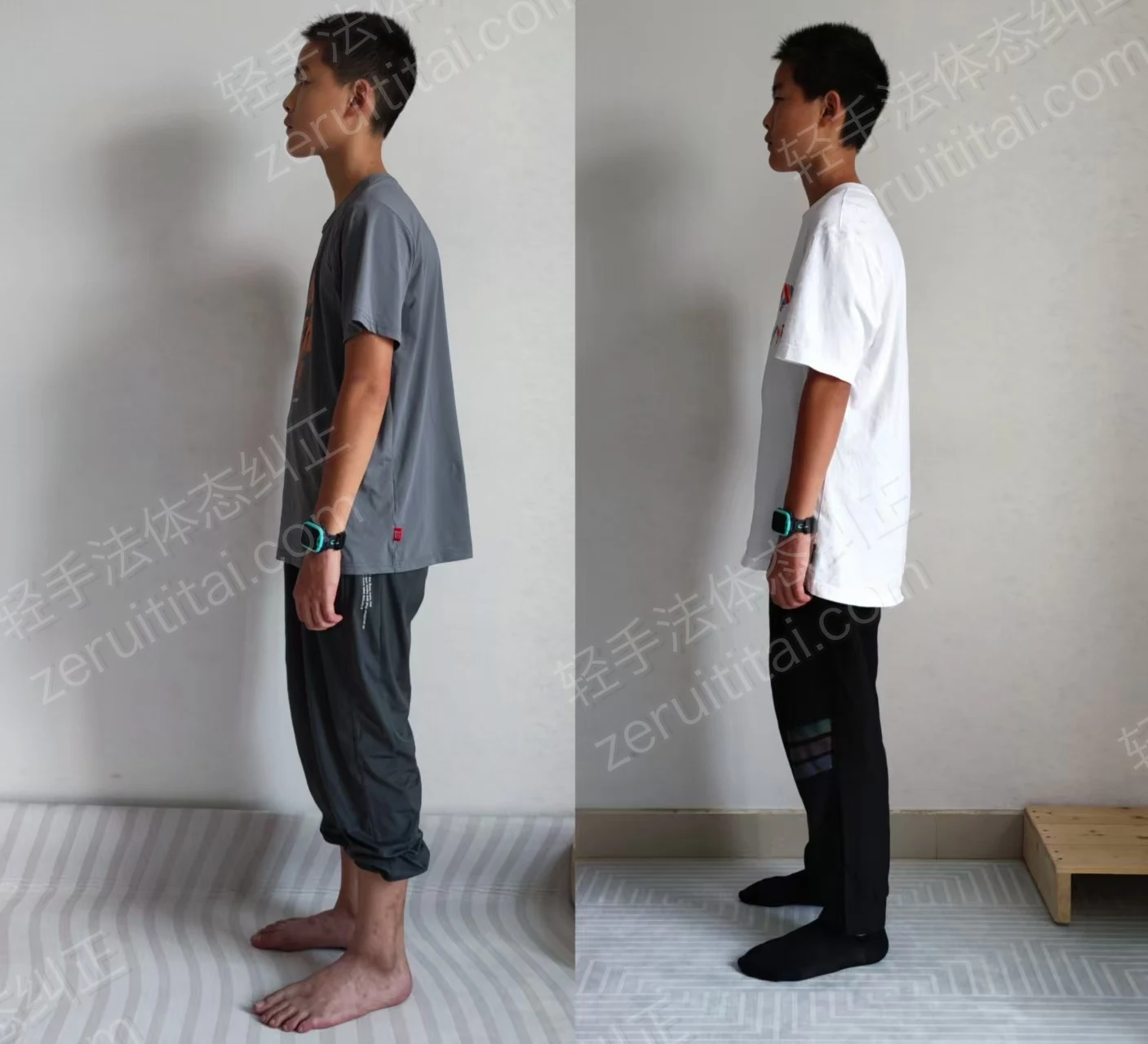 湖南初中生含胸驼背没气质｜含胸驼背、体态不佳案例