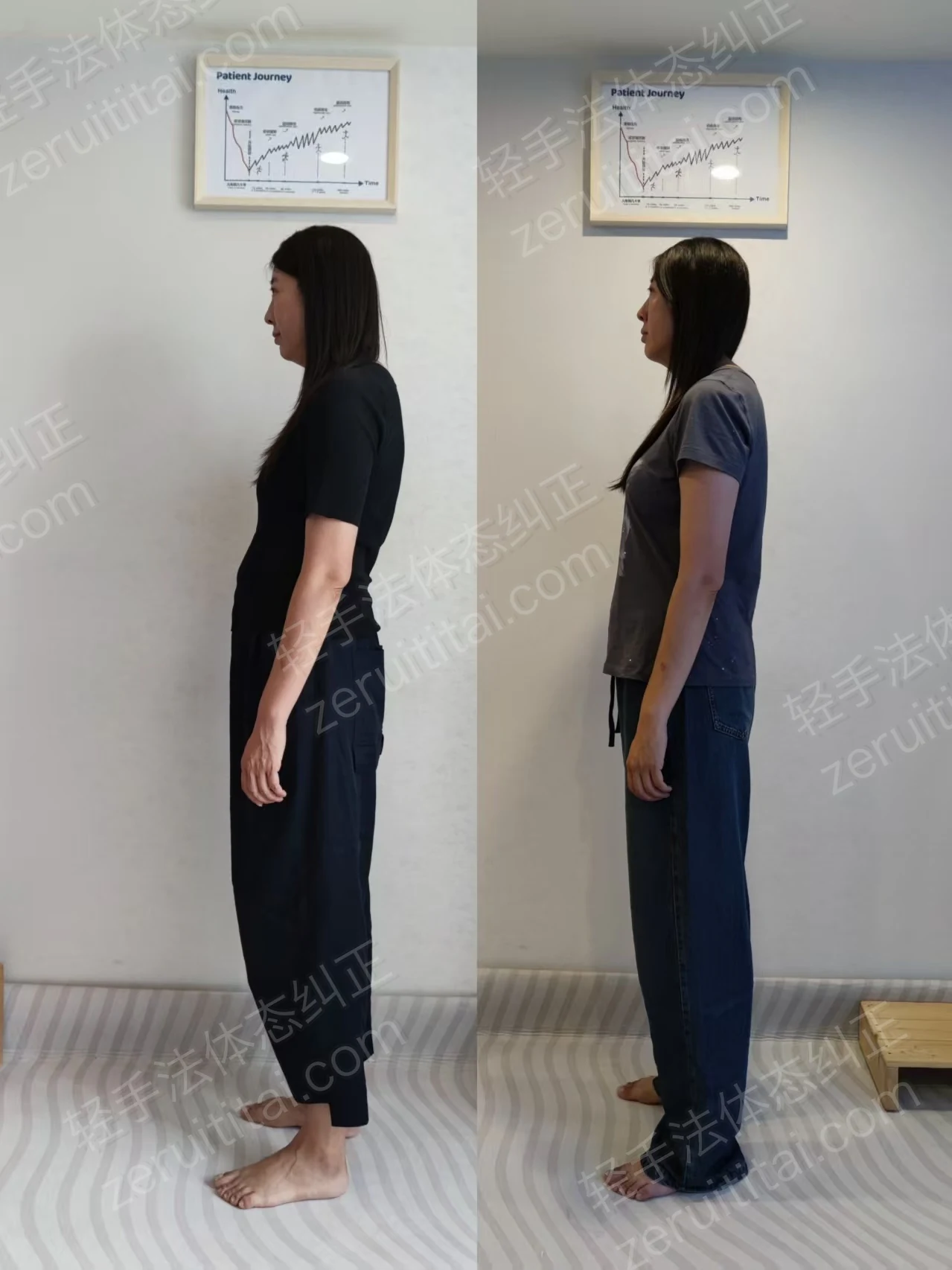 鄂尔多斯姐姐骨盆前倾富贵包