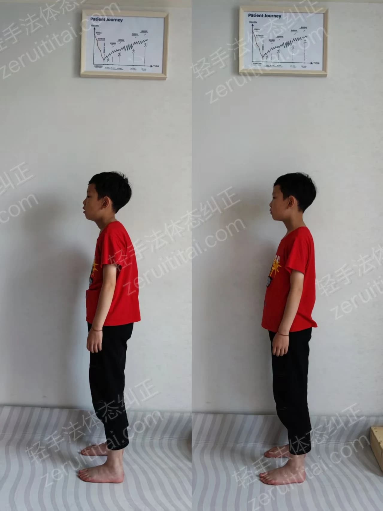 8岁小男孩含胸驼背没精神