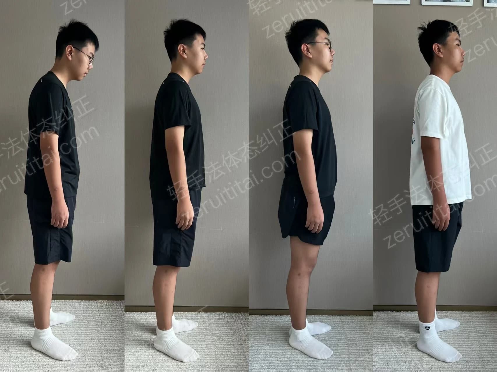 多次矫正阶段对比 02