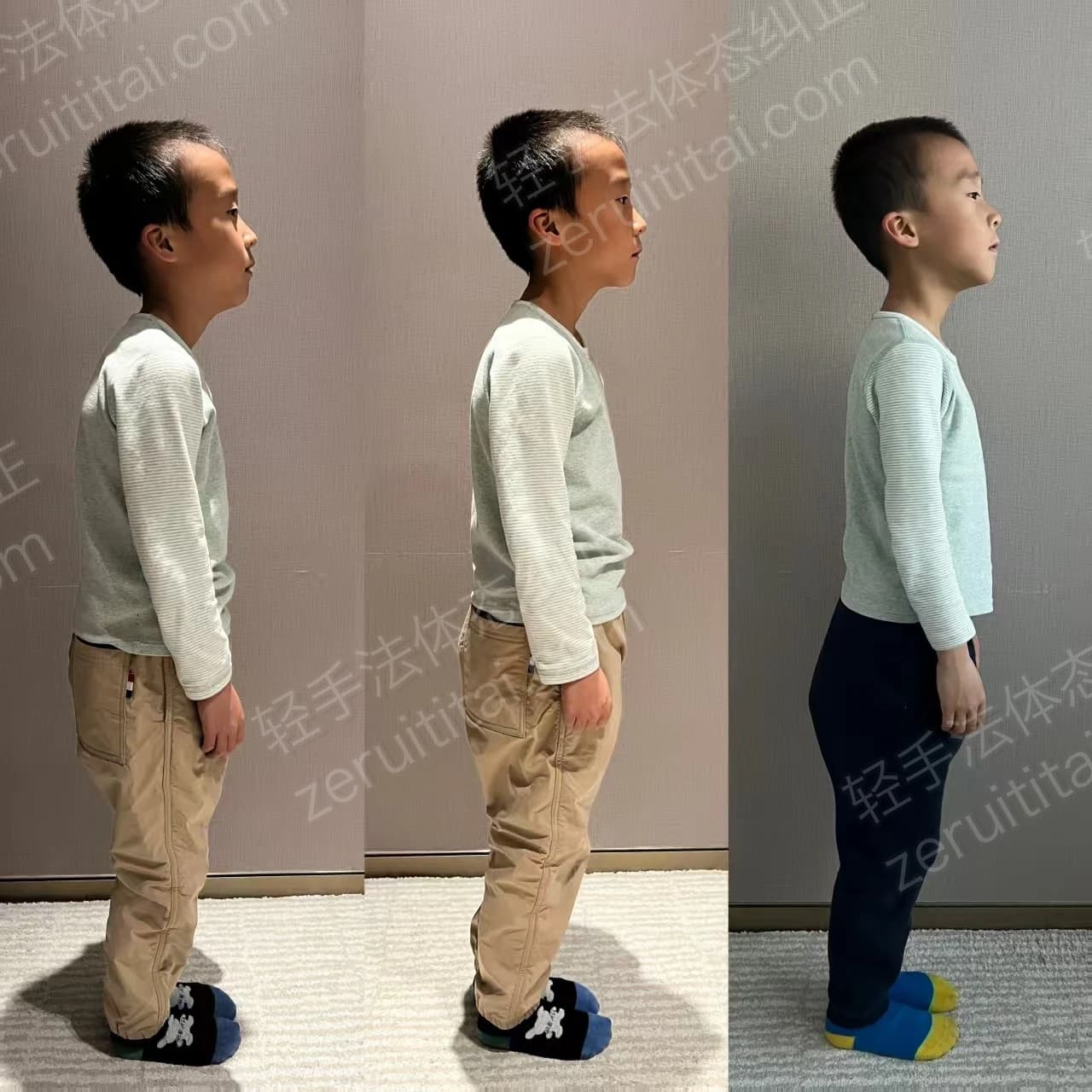 多次矫正阶段对比 04