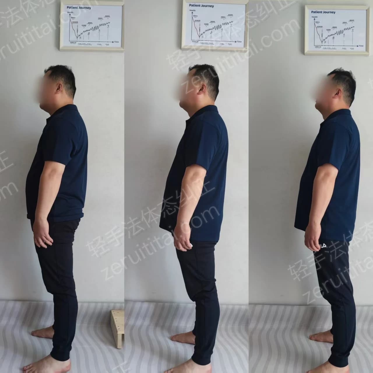 多次矫正阶段对比 11