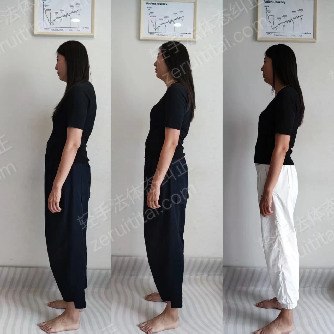 多次矫正阶段对比 13