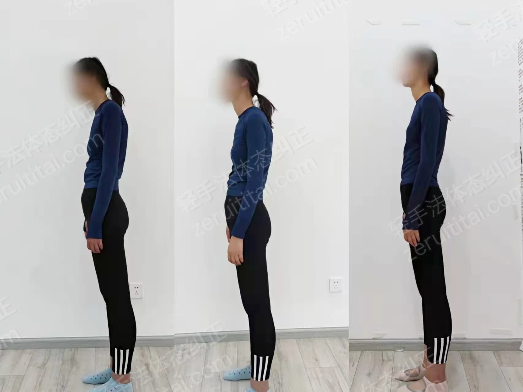 多次矫正阶段对比 14