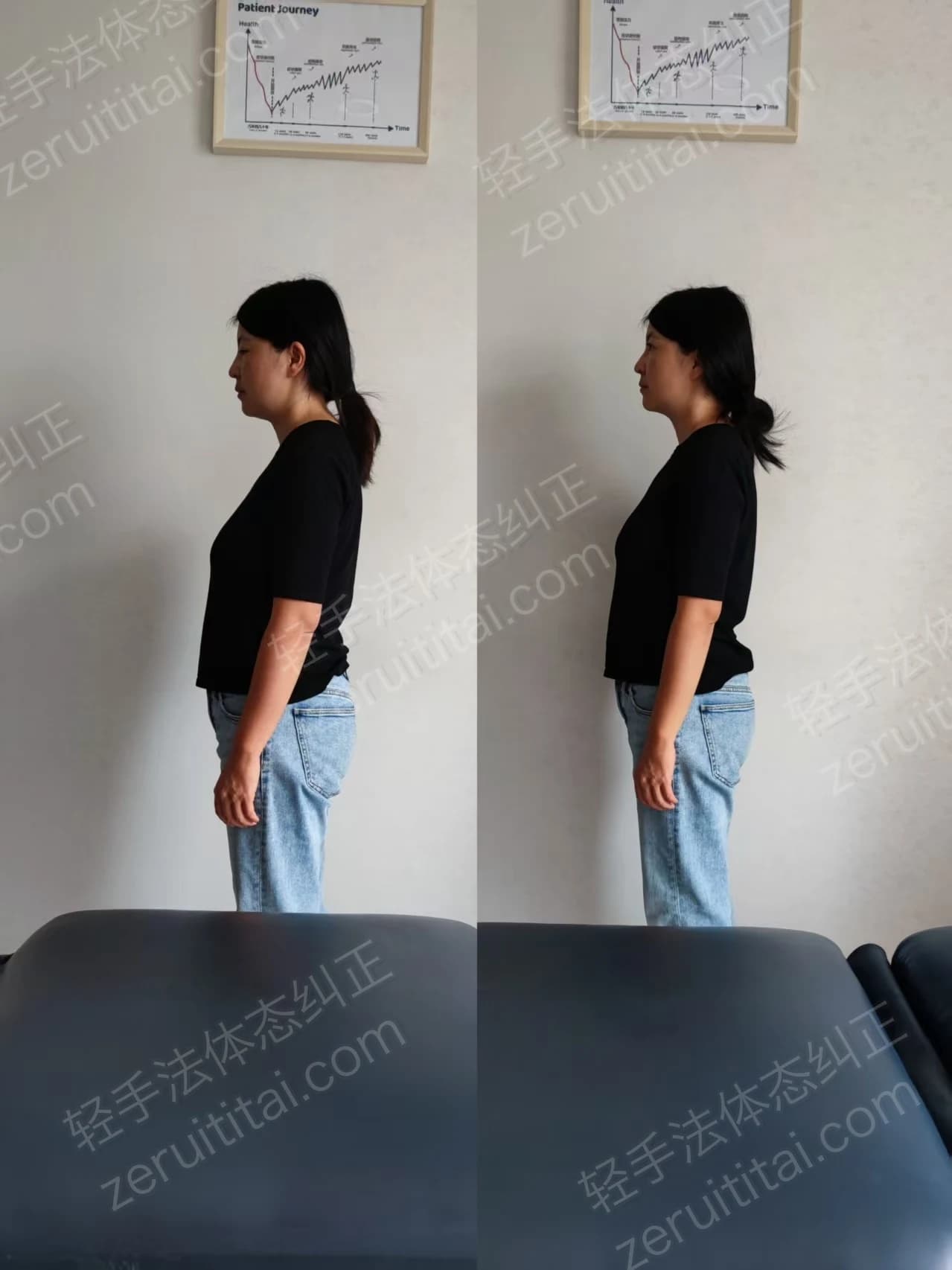 单次矫正案例对比 04