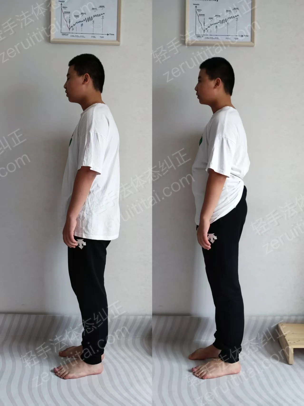 单次矫正案例对比 12