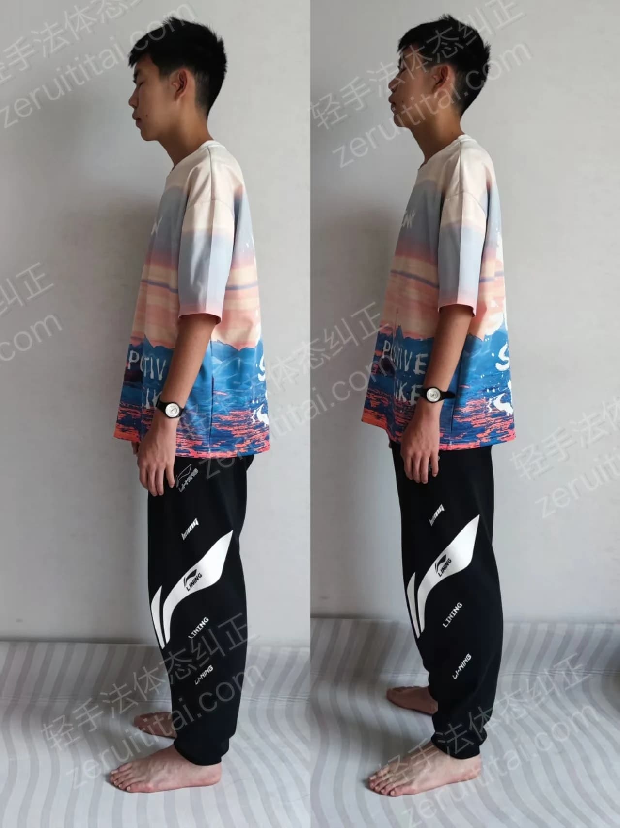 单次矫正案例对比 16