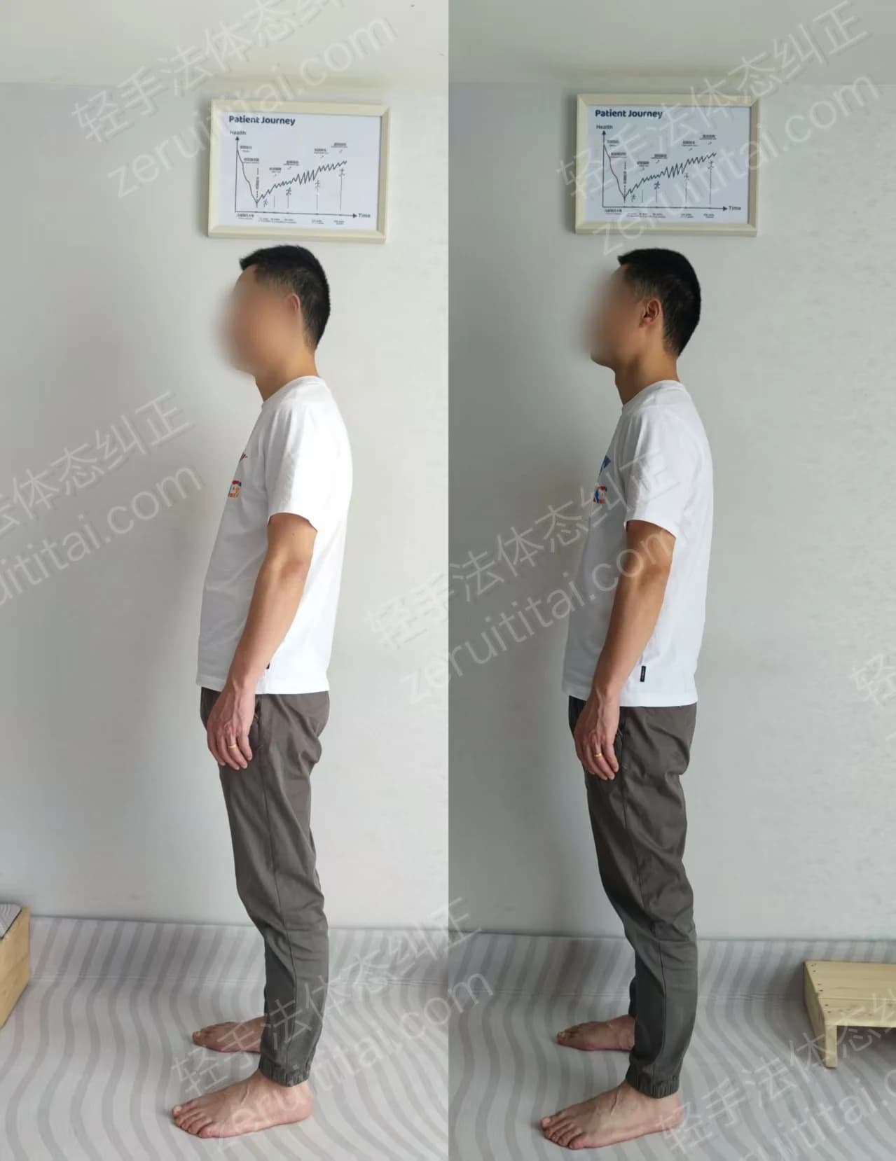 单次矫正案例对比 21