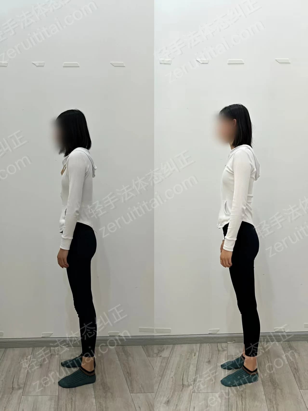 单次矫正案例对比 31