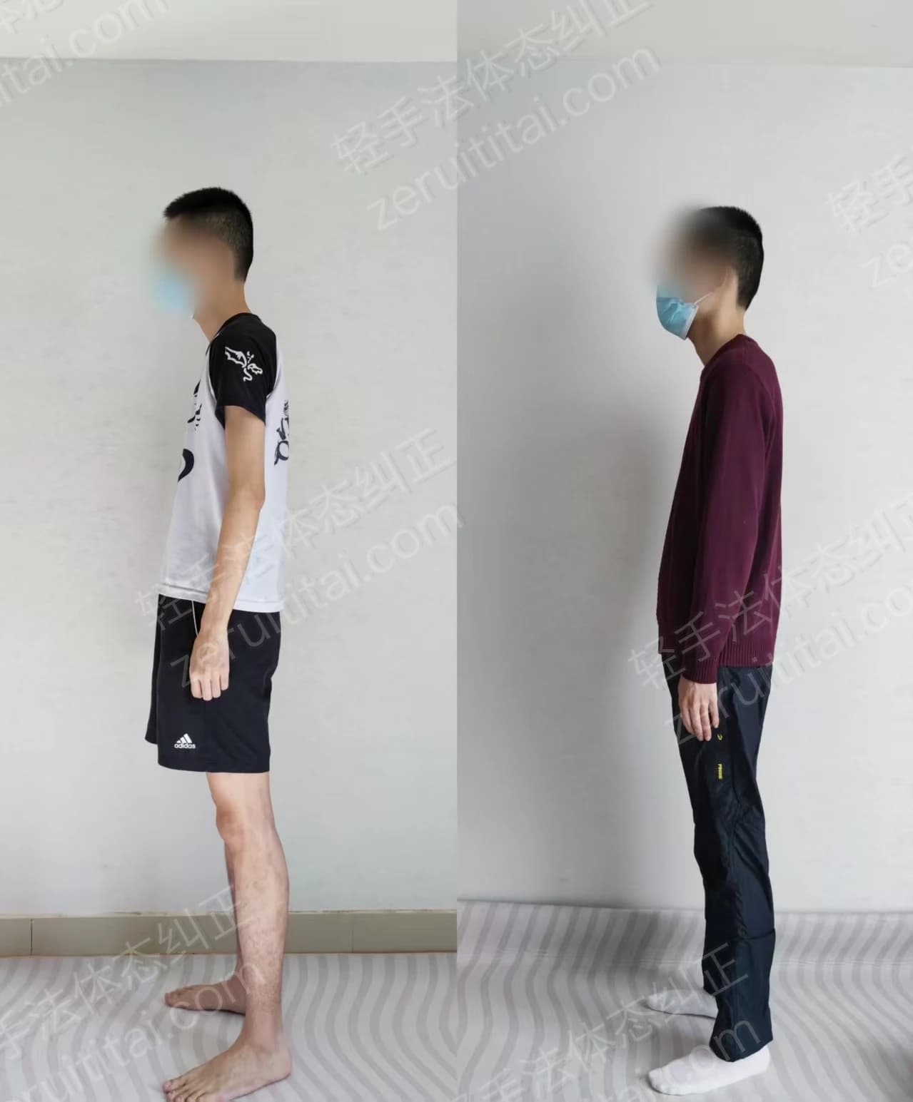 单次矫正案例对比 33