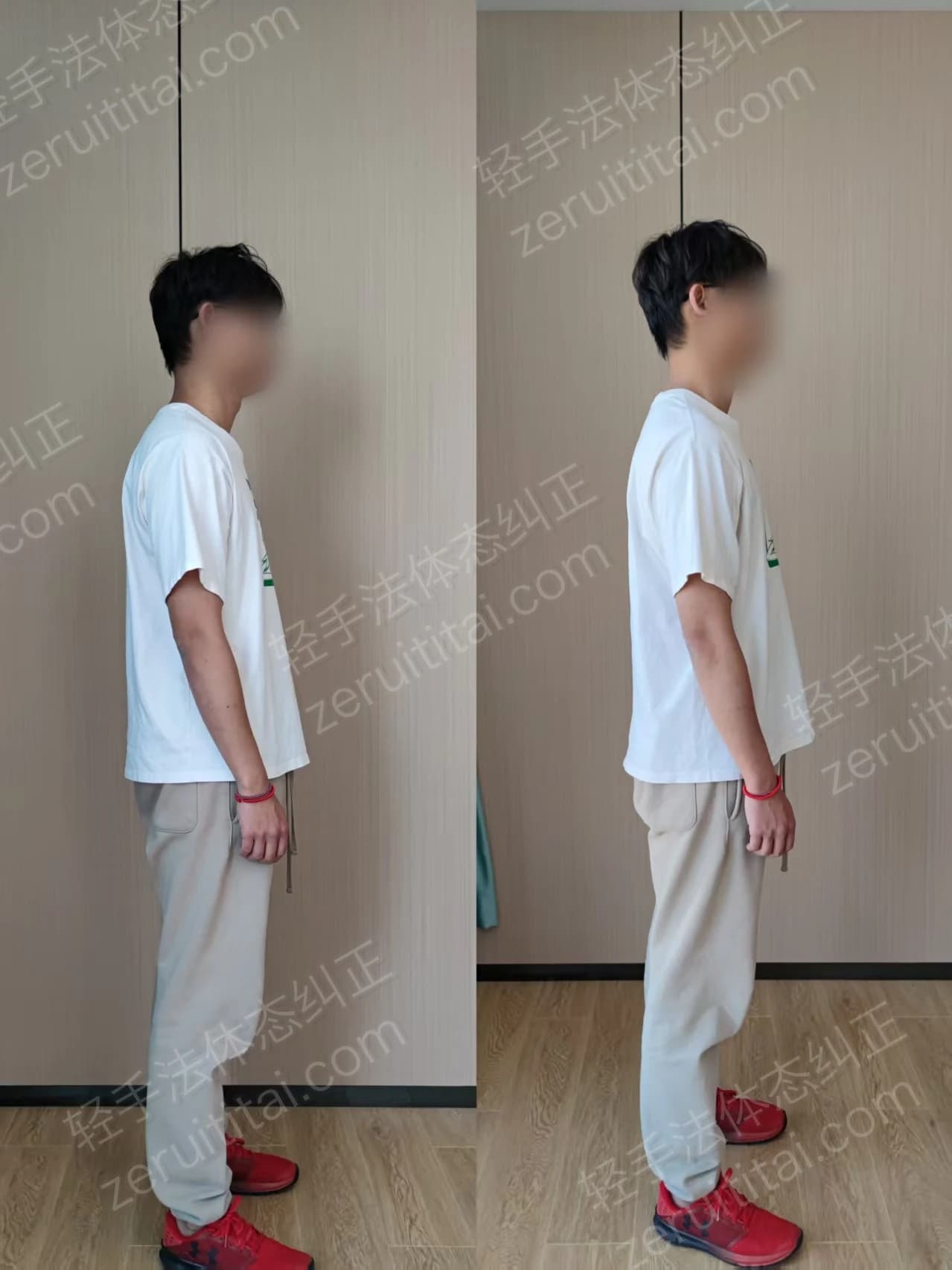 单次矫正案例对比 38