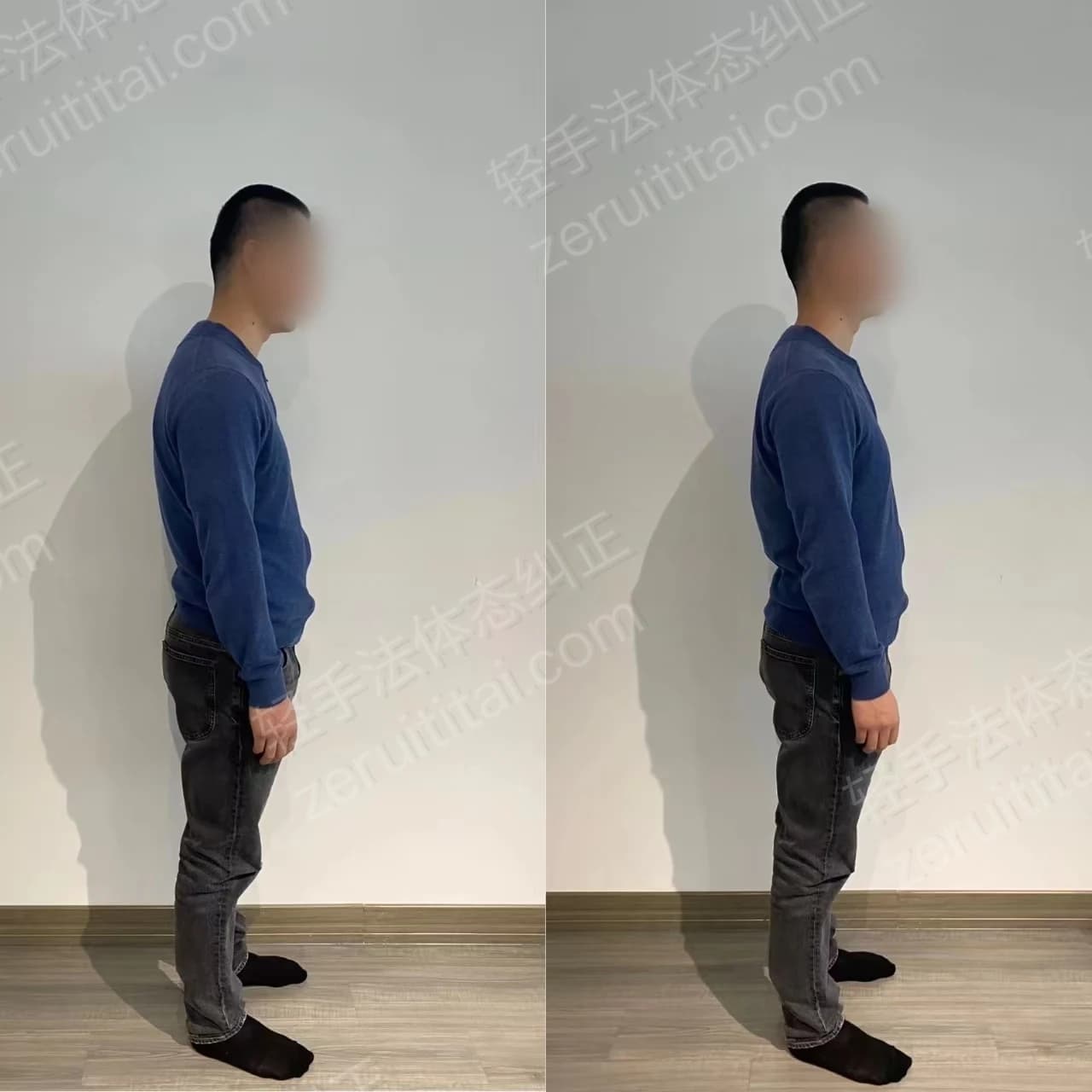 单次矫正案例对比 41