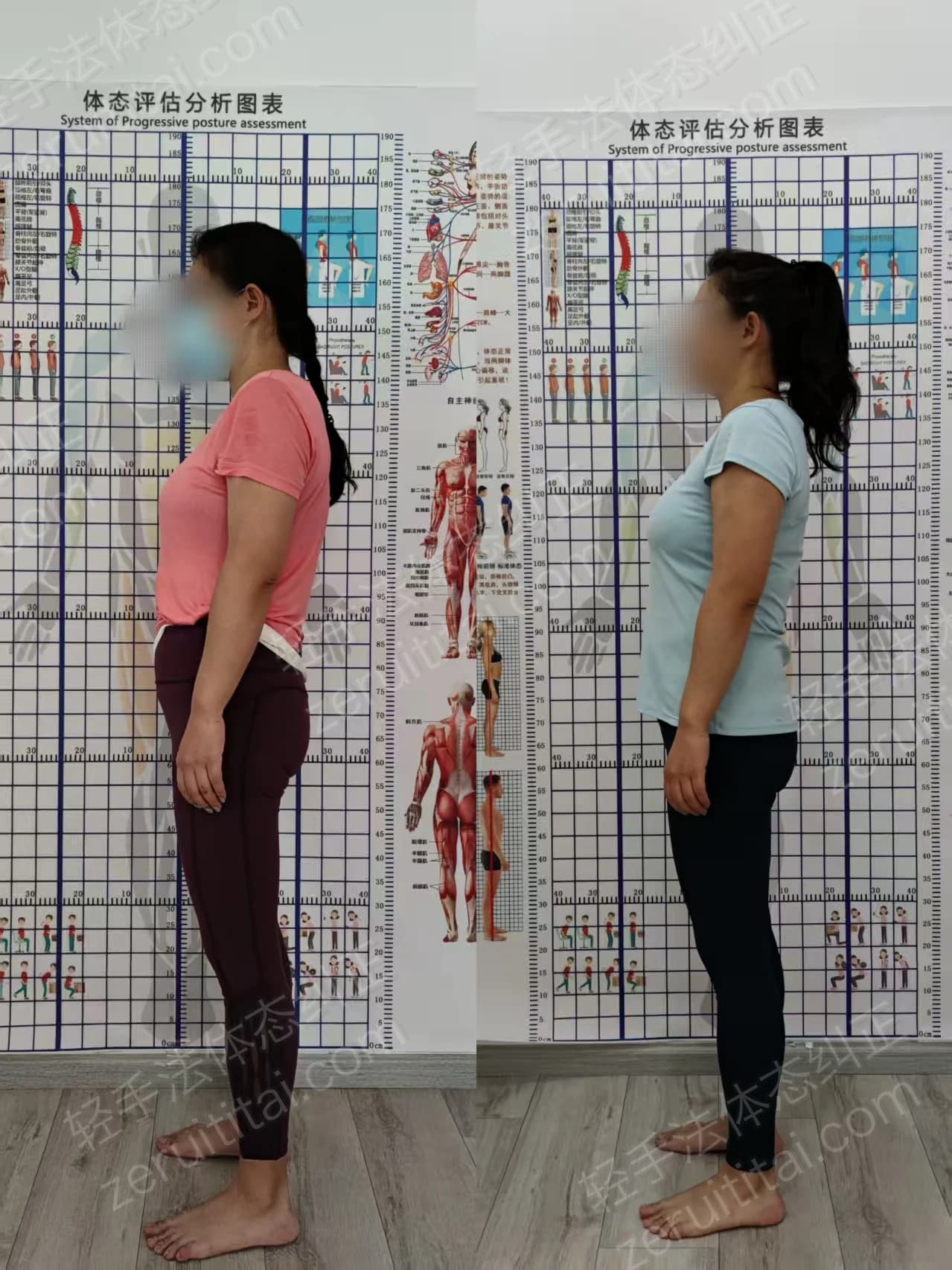 单次矫正案例对比 42