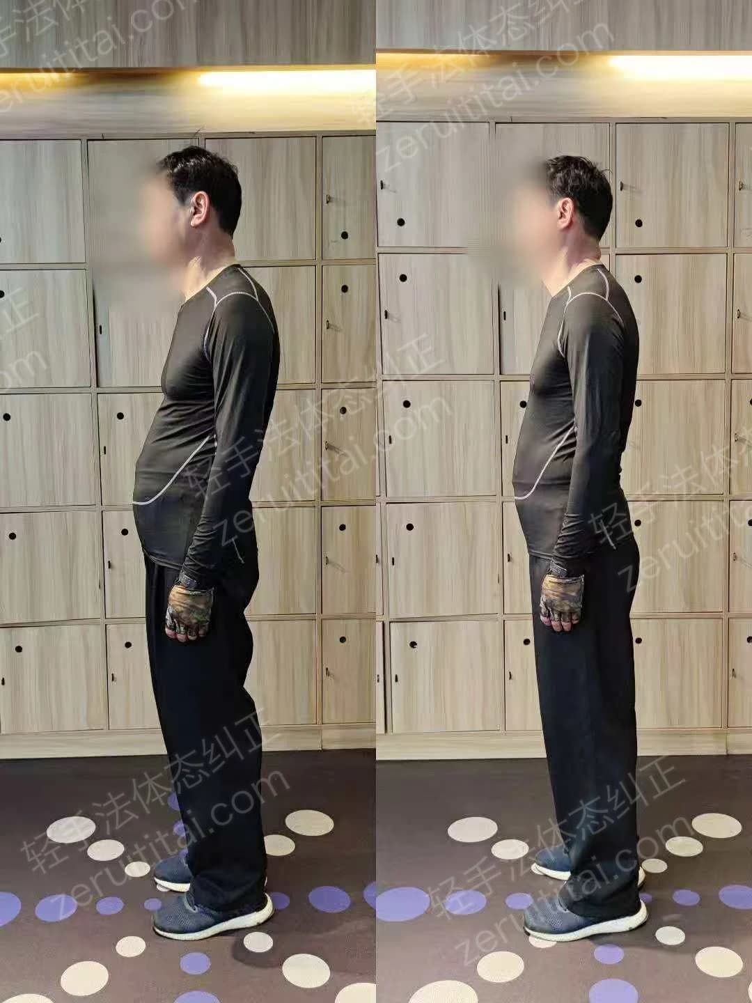 单次矫正案例对比 60