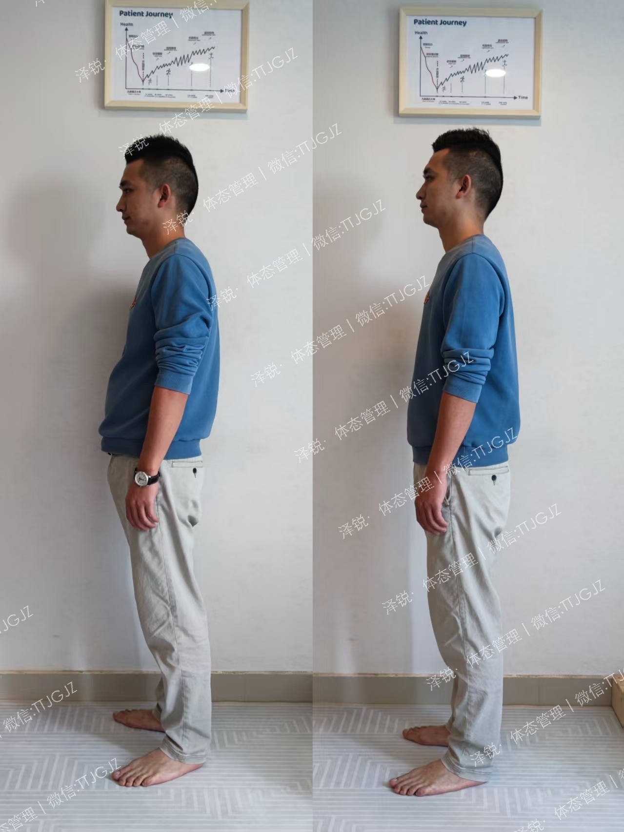 退伍兵哥哥骨盆前移