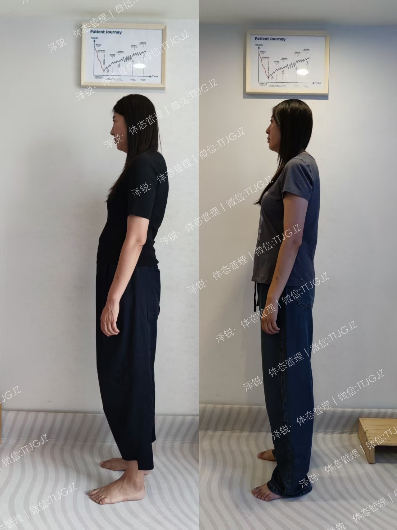 鄂尔多斯姐姐骨盆前倾富贵包