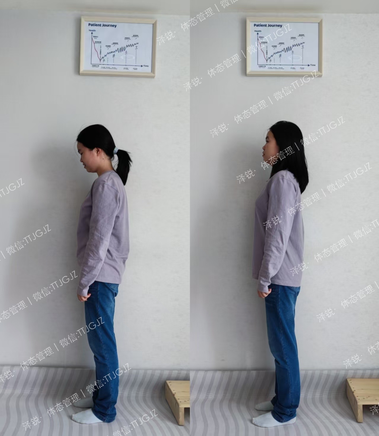 珠海小姐姐脊柱侧弯没气质